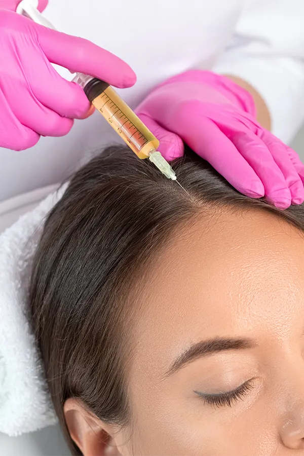 prp-scalp-injections-microneedling A clinician gives a woman's scalp regenerative medicine treatment. Get PRP microneedling scalp injections from Balanced Medical Solutions in San Francisco Bay Area.